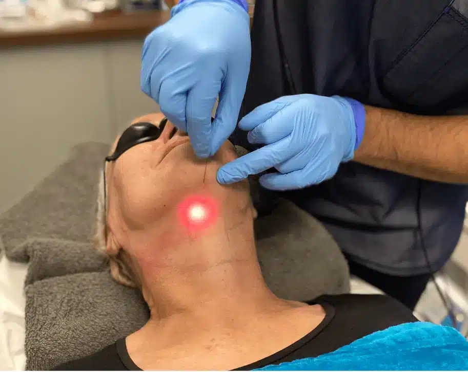 Vaginal Rejuvenation with Endo-One Diode Laser in Miami, FL