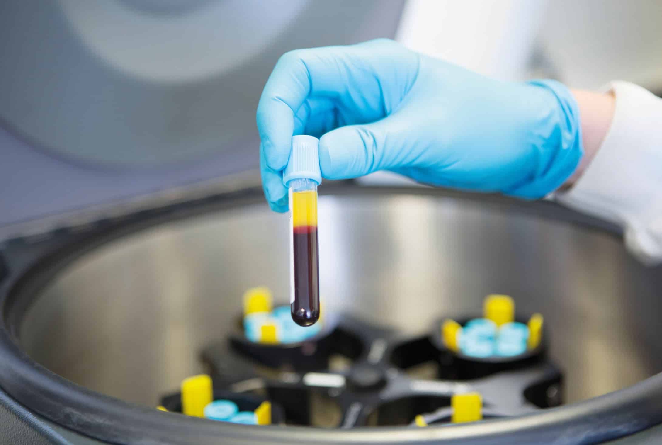 Dynamite Protocol™ in Miami, FL