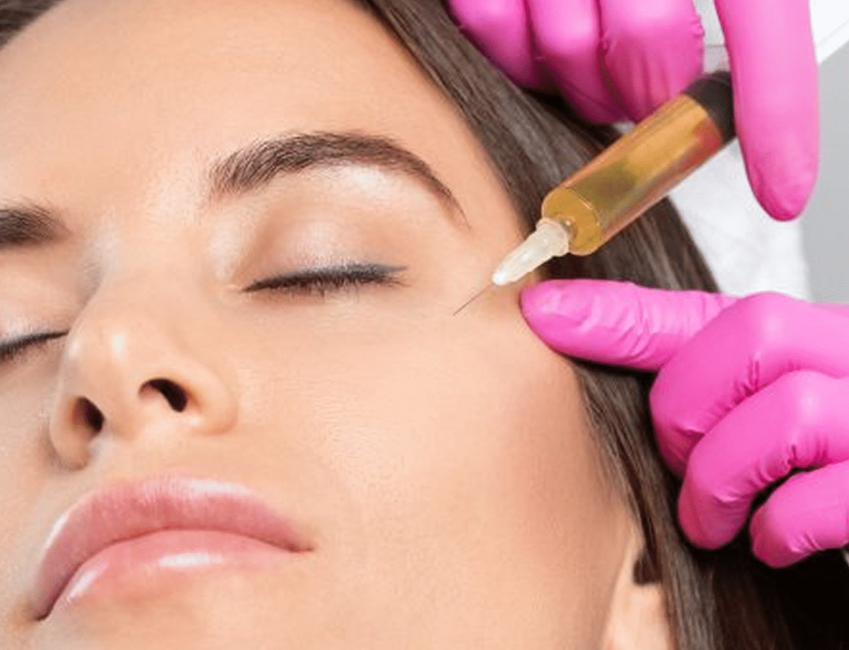 Endo-One Laser for Face & Neck Rejuvenation in Miami, FL