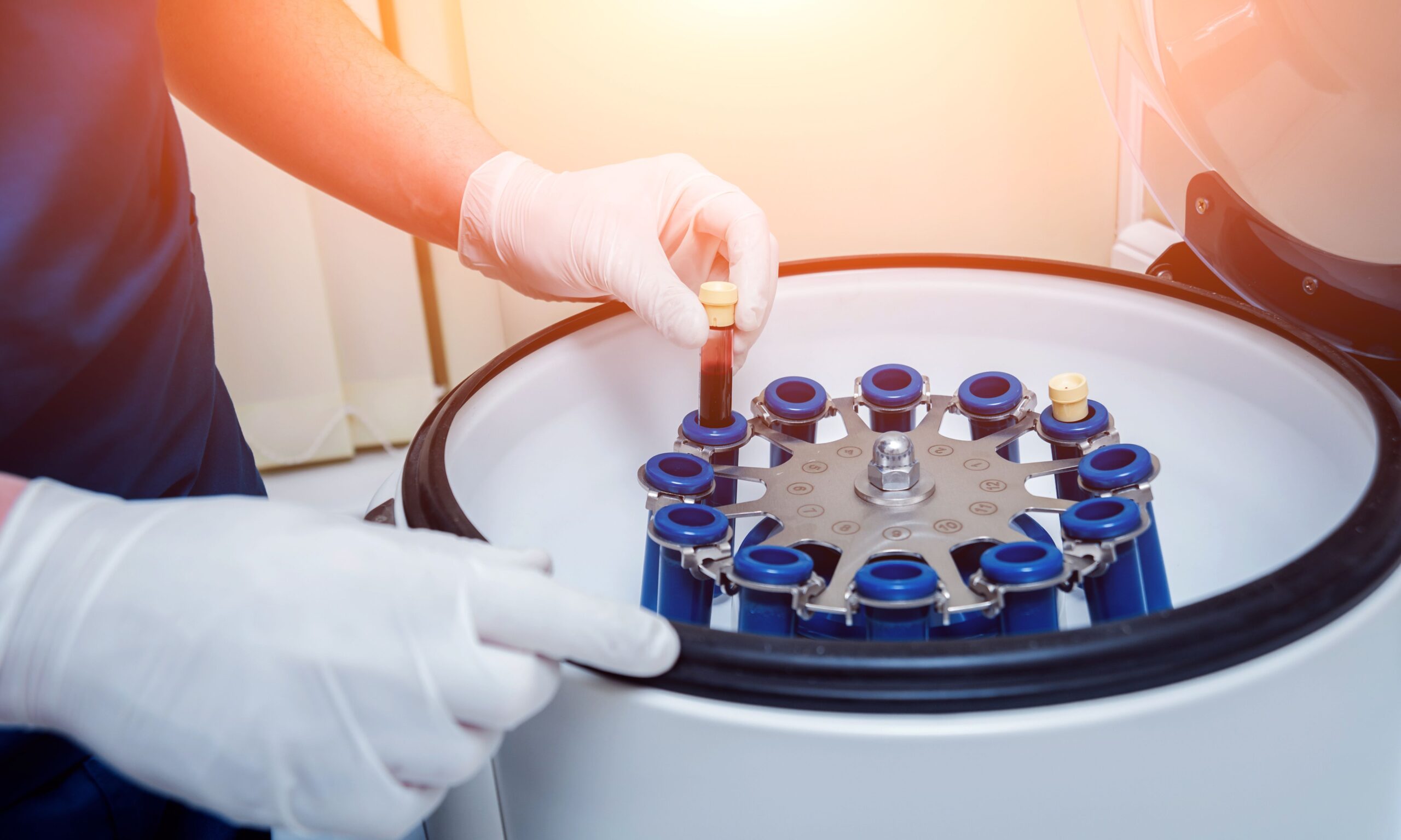 Non-Surgical Blepharoplasty Protocol in Miami, FL