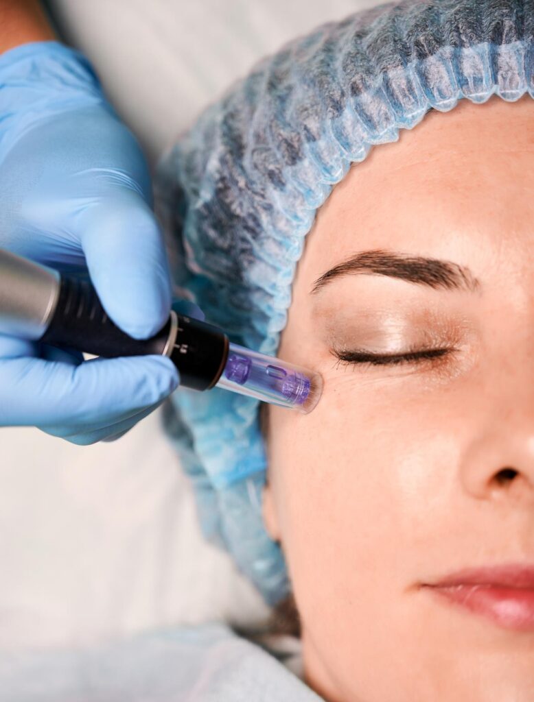 Non-Surgical Blepharoplasty Protocol in Miami, FL