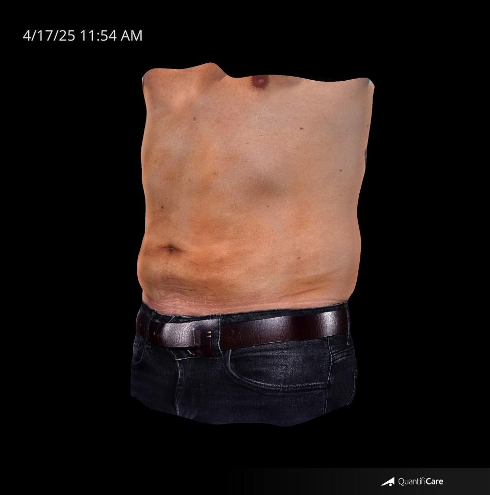 After Image: Endo-One - left-front-oblique