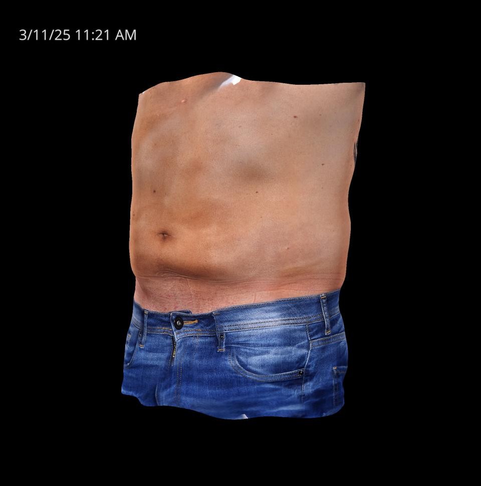 Before Image: Endo-One - left-front-oblique