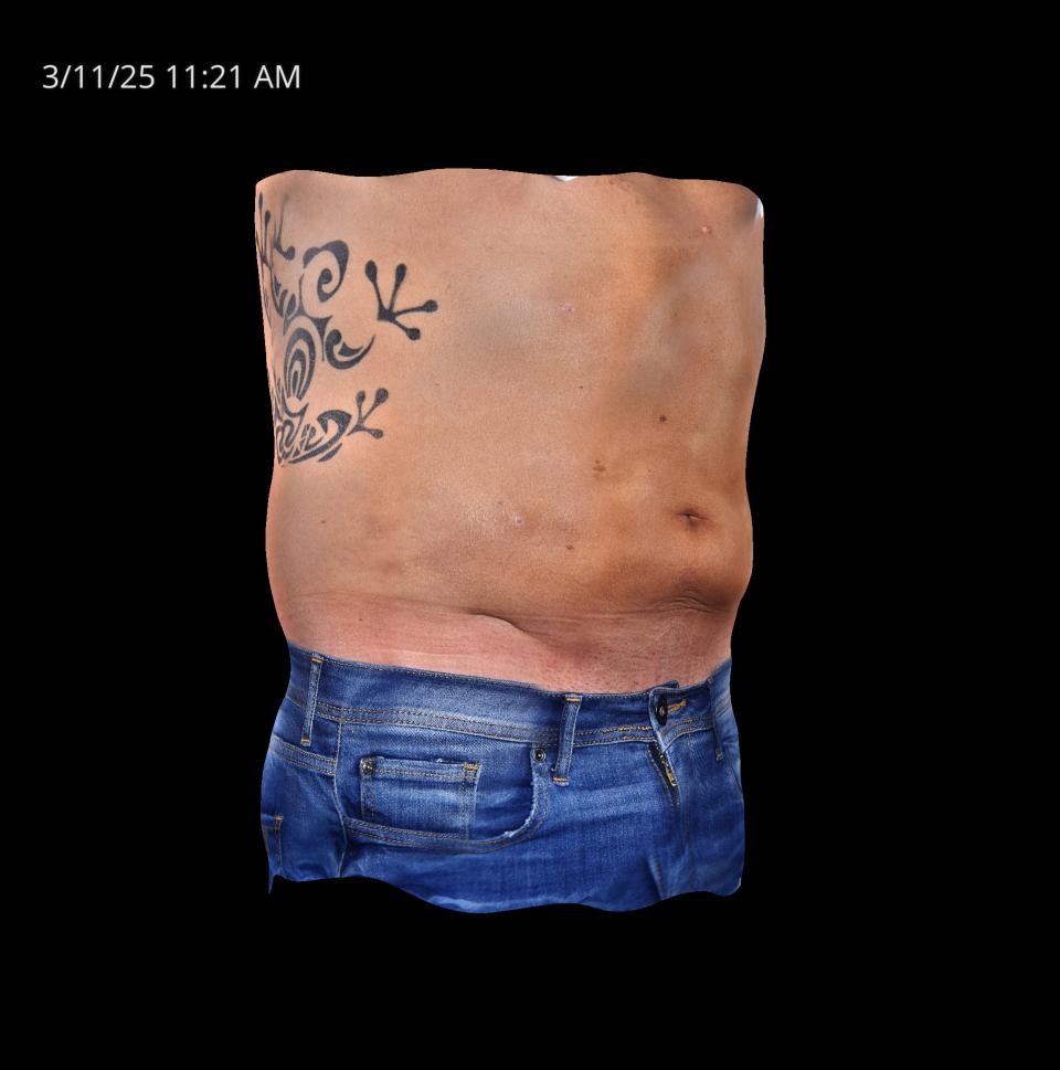 Before Image: Endo-One - right-front-oblique