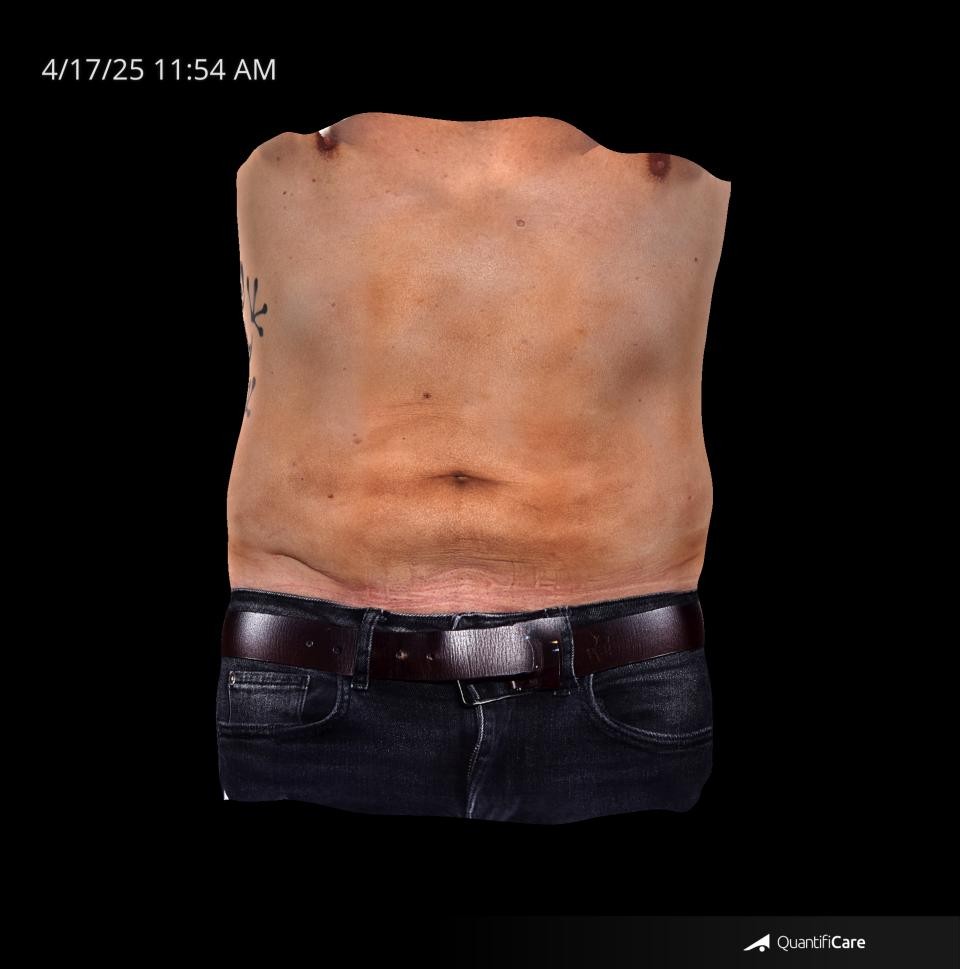 After Image: Endo-One - front