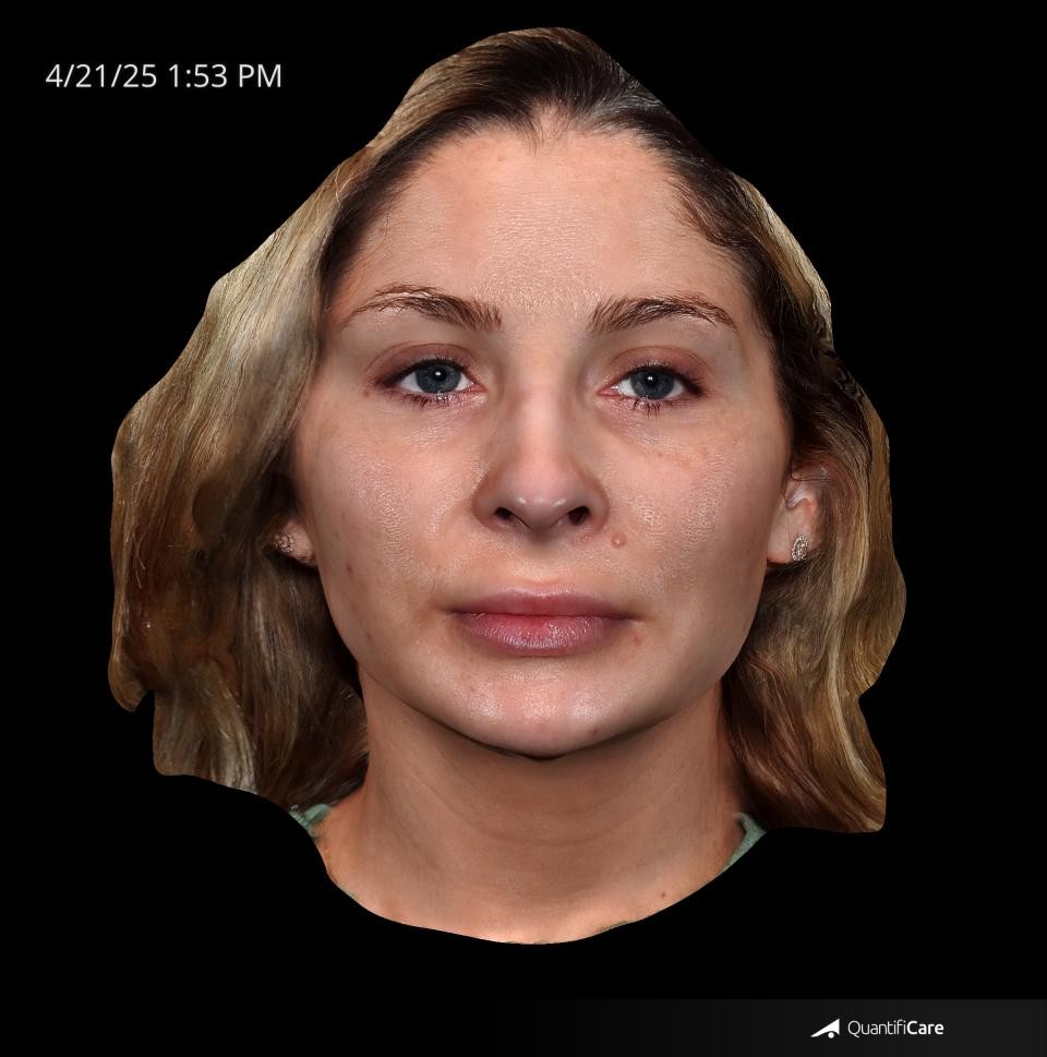 After Image: Plasma Gel – Tear Through - front